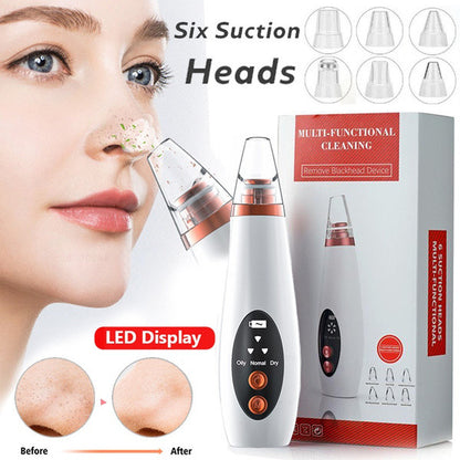 Multifunctional Blackhead Remover Machine